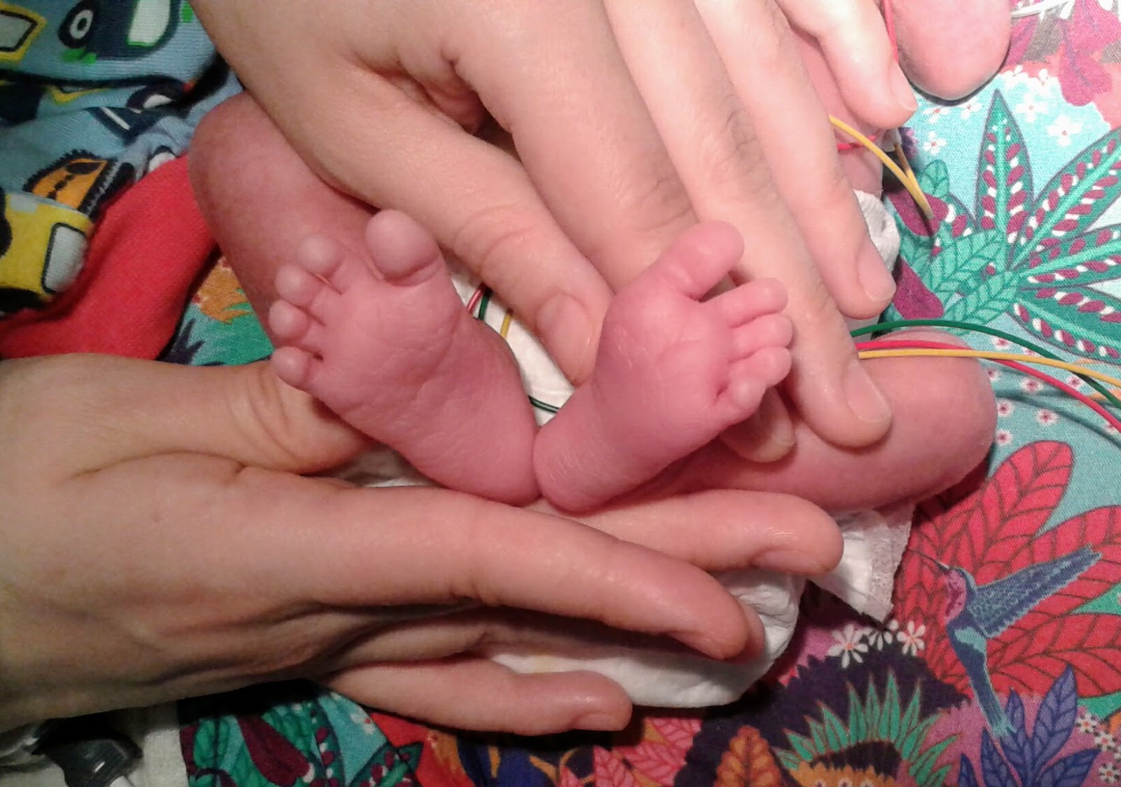 premature baby feet